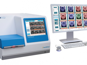 Preimplantation embryo quality