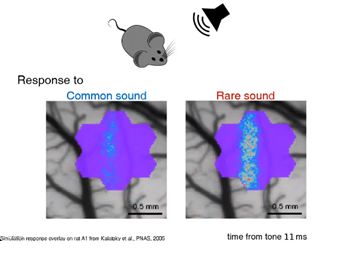 Towards a digital brain